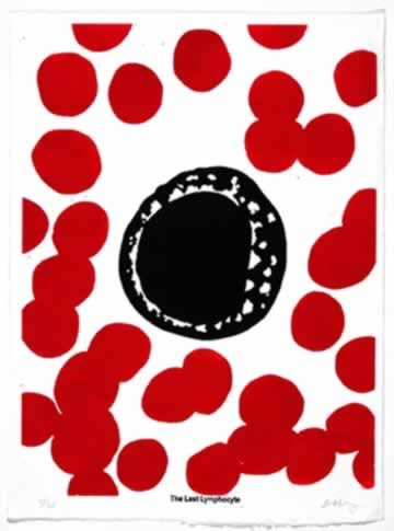The Last Lymphocyte